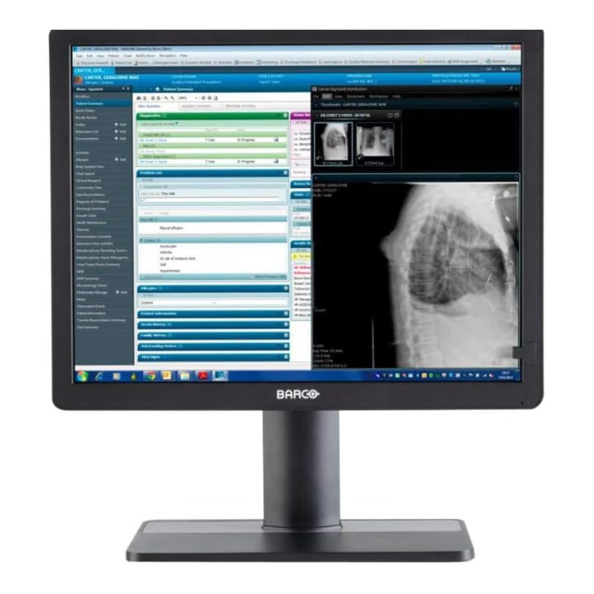 Barco Medical Monitor